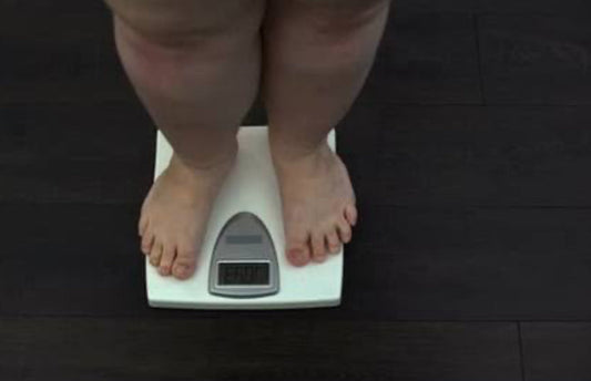 Obesidad: Conoce sus causas y encuentra tu mejor solución